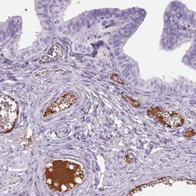 Immunohistochemistry-Paraffin: CD5L Antibody [NBP2-39094]