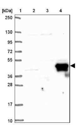 Western Blot: CD5L Antibody [NBP2-39094]