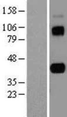 Western Blot: CD5L Overexpression Lysate [NBL1-08959]