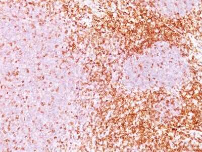 Immunohistochemistry-Paraffin: CD6 Antibody (3F7B5) - Azide and BSA Free [NBP2-34537]