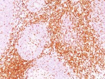 Immunohistochemistry-Paraffin: CD6 Antibody (3F7B5) - Azide and BSA Free [NBP2-34537]