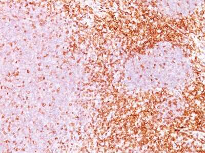 Immunohistochemistry-Paraffin: CD6 Antibody (3F7B5) [NBP2-32942]