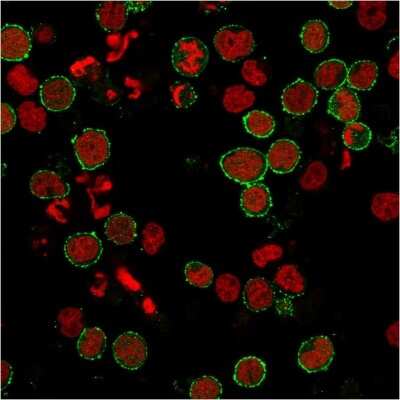 Immunocytochemistry/ Immunofluorescence: CD6 Antibody (C6/2884R) - Azide and BSA Free [NBP3-08281]