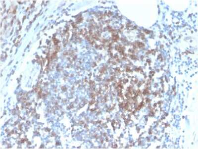 Immunohistochemistry-Paraffin: CD6 Antibody (C6/2884R) - Azide and BSA Free [NBP3-08281]