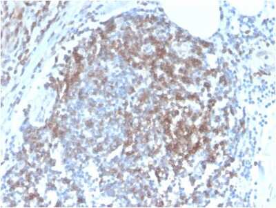 Immunohistochemistry-Paraffin: CD6 Antibody (C6/2884R) [NBP3-07555]