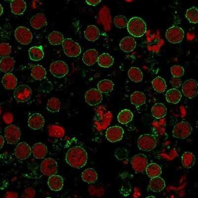 Immunocytochemistry/ Immunofluorescence: CD6 Antibody (C6/372+3F7B5) - Azide and BSA Free [NBP2-34585]