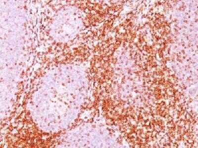 Immunohistochemistry-Paraffin: CD6 Antibody (C6/372) - Azide and BSA Free [NBP2-34584]
