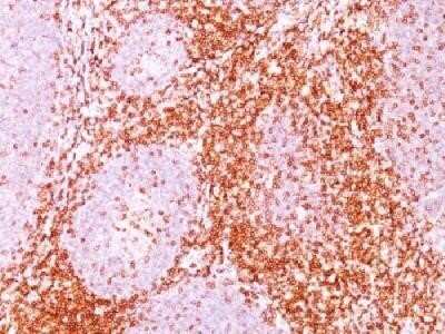 Immunohistochemistry-Paraffin: CD6 Antibody (C6/372) - IHC-Prediluted [NBP2-44554]