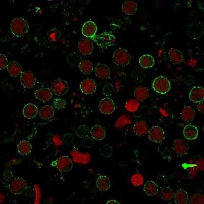 Immunocytochemistry/ Immunofluorescence: CD6 Antibody (SPM547) - Azide and BSA Free [NBP2-34789]