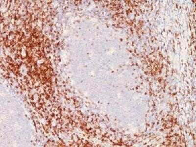 Immunohistochemistry-Paraffin: CD6 Antibody (SPM547) - Azide and BSA Free [NBP2-34789]