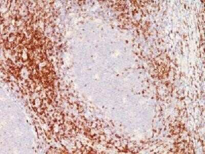 Immunohistochemistry-Paraffin: CD6 Antibody (SPM547) - IHC-Prediluted [NBP2-44555]