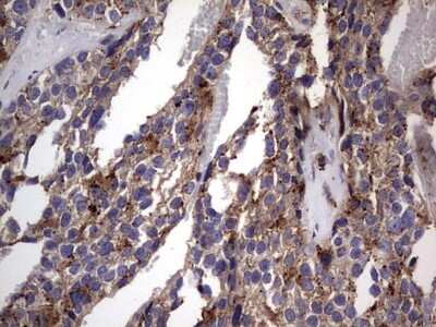 Immunohistochemistry: CD63 Antibody (OTI5E5) [NBP2-46167]