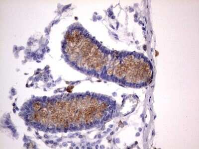 Immunohistochemistry: CD63 Antibody (OTI5E5) [NBP2-46167]