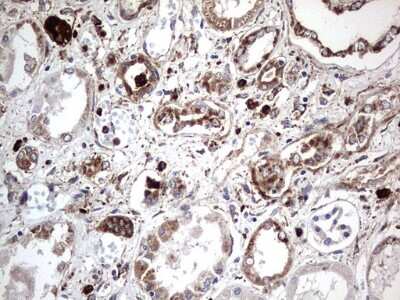 Immunohistochemistry: CD63 Antibody (OTI5E5) [NBP2-46167]