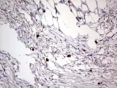 Immunohistochemistry: CD63 Antibody (OTI5E5) [NBP2-46167]