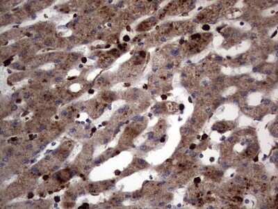 Immunohistochemistry: CD63 Antibody (OTI5E5) [NBP2-46167]