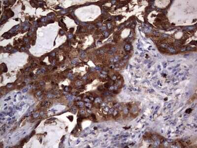 Immunohistochemistry: CD63 Antibody (OTI5E5) [NBP2-46167]