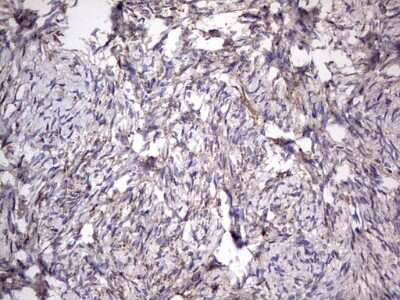 Immunohistochemistry: CD63 Antibody (OTI5E5) [NBP2-46167]
