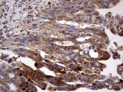 Immunohistochemistry: CD63 Antibody (OTI5E5) [NBP2-46167]
