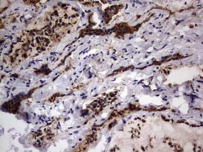 Immunohistochemistry: CD63 Antibody (OTI5E5) [NBP2-46167]