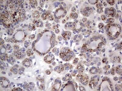 Immunohistochemistry: CD63 Antibody (OTI5E5) [NBP2-46167]