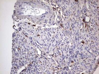 Immunohistochemistry: CD63 Antibody (OTI5E5) [NBP2-46167]
