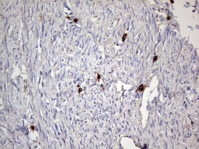 Immunohistochemistry: CD63 Antibody (OTI5E5) [NBP2-46167]