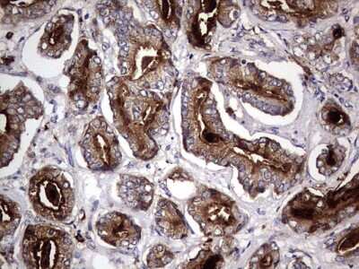 Immunohistochemistry: CD63 Antibody (OTI5E5) [NBP2-46167]