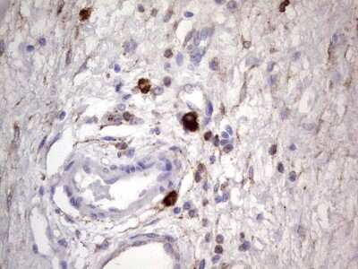 Immunohistochemistry: CD63 Antibody (OTI5E5) [NBP2-46167]