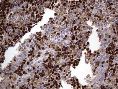 Immunohistochemistry: CD63 Antibody (OTI5E5) [NBP2-46167]