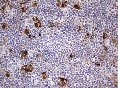 Immunohistochemistry: CD63 Antibody (OTI5E5) [NBP2-46167]