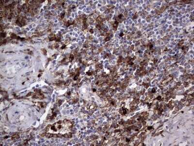 Immunohistochemistry: CD63 Antibody (OTI5E5) [NBP2-46167]