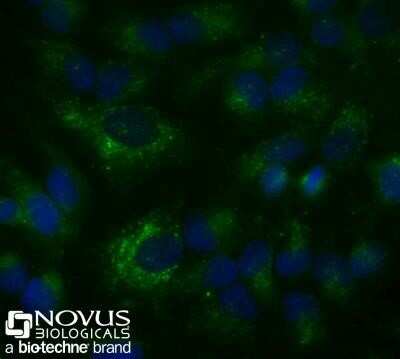 Immunocytochemistry/ Immunofluorescence: CD63 Antibody (H5C6) - Azide and BSA Free [NBP2-80654]