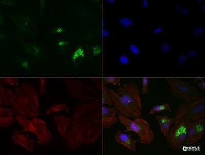 Immunocytochemistry/ Immunofluorescence: CD63 Antibody (H5C6) - Azide and BSA Free [NBP2-80654]