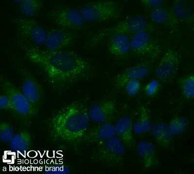 Immunocytochemistry/ Immunofluorescence: CD63 Antibody (H5C6) - BSA Free [NBP2-42225]