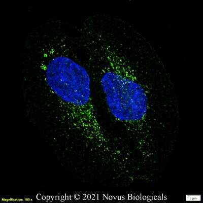 Immunocytochemistry/ Immunofluorescence: CD63 Antibody (H5C6) - BSA Free [NBP2-42225]