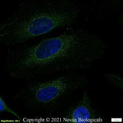 Immunocytochemistry/ Immunofluorescence: CD63 Antibody (H5C6) - BSA Free [NBP2-42225]