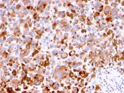 Immunohistochemistry-Paraffin: CD63 Antibody (LAMP3/2788) [NBP2-78812]