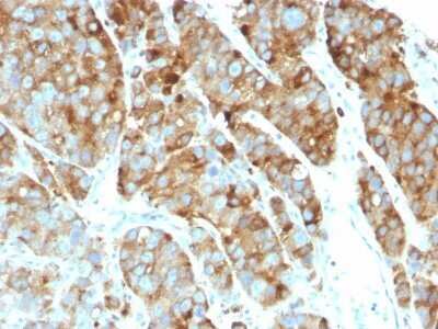 Immunohistochemistry-Paraffin: CD63 Antibody (LAMP3/968) - Azide and BSA Free [NBP2-47936]