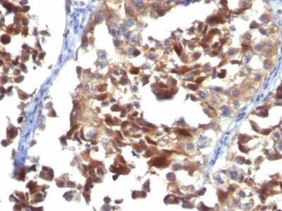 Immunohistochemistry-Paraffin: CD63 Antibody (LAMP3/968) - IHC-Prediluted [NBP2-48021]