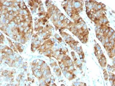 Immunohistochemistry-Paraffin: CD63 Antibody (LAMP3/968) - IHC-Prediluted [NBP2-48021]