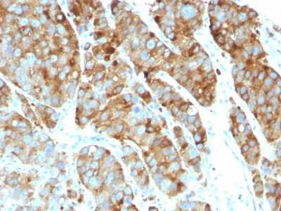 Immunohistochemistry-Paraffin: CD63 Antibody (LAMP3/968) [NBP2-44810]