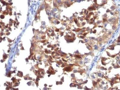 Immunohistochemistry-Paraffin: CD63 Antibody (LAMP3/968) [NBP2-44810]