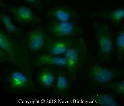 Immunocytochemistry/ Immunofluorescence: CD63 Antibody (MX-49.129.5) - Azide and BSA Free [NBP2-34689]