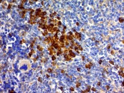 Immunohistochemistry-Paraffin: CD63 Antibody (MX-49.129.5) - IHC-Prediluted [NBP2-44808]