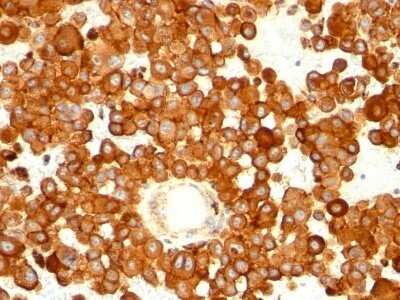 Immunohistochemistry-Paraffin: CD63 Antibody (MX-49.129.5) - IHC-Prediluted [NBP2-44808]