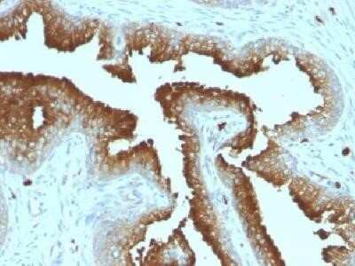 Immunohistochemistry-Paraffin: CD63 Antibody (MX-49.129.5) - IHC-Prediluted [NBP2-44808]