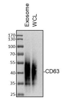 Western Blot: CD63 Antibody (MX-49.129.5) [NBP2-32830]