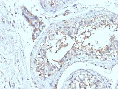 Immunohistochemistry-Paraffin: CD63 Antibody (NKI/C3 + LAMP3/968) - Azide and BSA Free [NBP2-47937]
