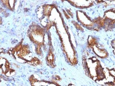 Immunohistochemistry-Paraffin: CD63 Antibody (NKI/C3 + LAMP3/968) - Azide and BSA Free [NBP2-47937]
